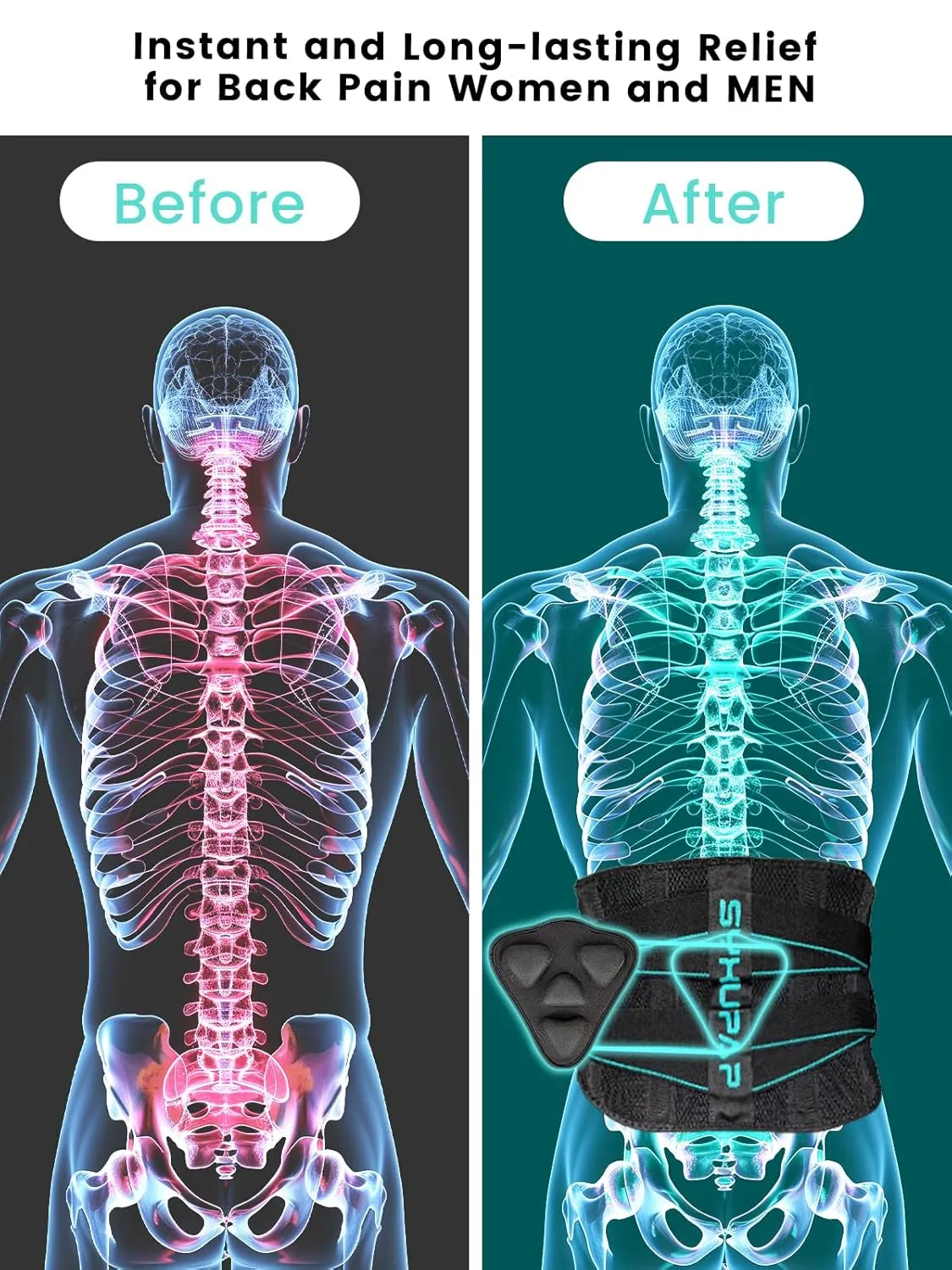 SYXUPAP Back Braces for Lower Back Pain Women and Men, Lumbar Support Belts for Men and Women with Anti-skid Lumbar Strips Pad, For Sciatica, Scoliosis, Heavy Lifting and Work, with Adjustable System
